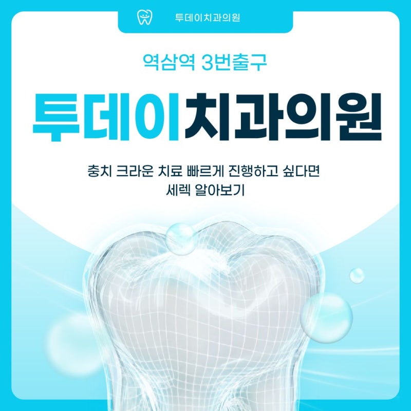 충치 크라운 치료 빠르게 진행하고 싶다면 세렉 알아보기