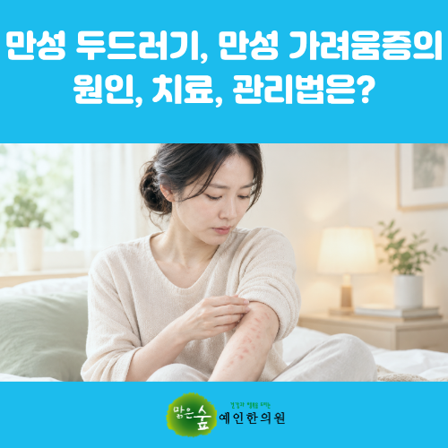 울산 만성 두드러기, 만성 가려움증의 원인, 치료, 관리법은? [피부질환 5부]