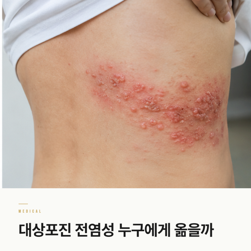 대상포진 전염성 누구에게 옮을까 초기증상과 가족 주의점