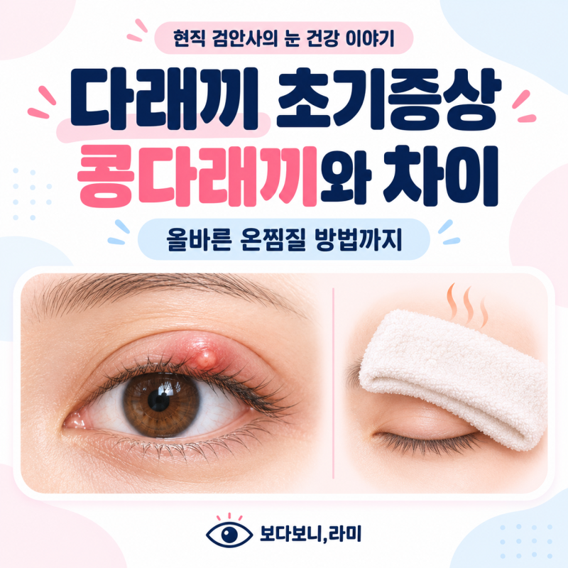 다래끼 초기증상, 콩다래끼와 차이부터 온찜질 방법까지