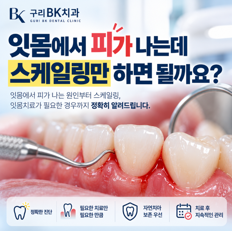구리 치과, 잇몸에서 피가 나는데 스케일링만 하면 될까요?