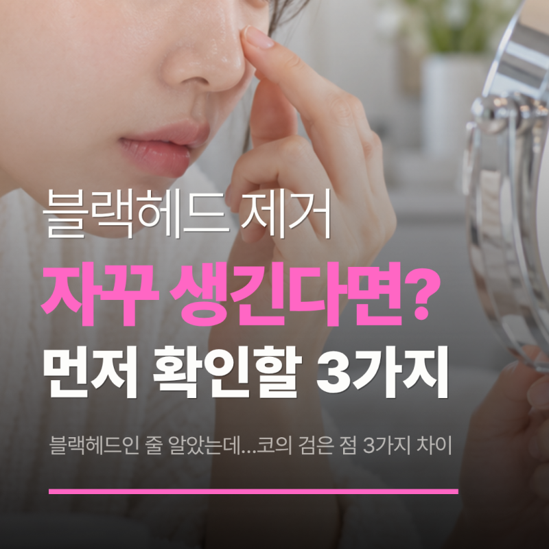 블랙헤드 제거해도 자꾸 생긴다면? 코팩보다 먼저 확인할 3가지