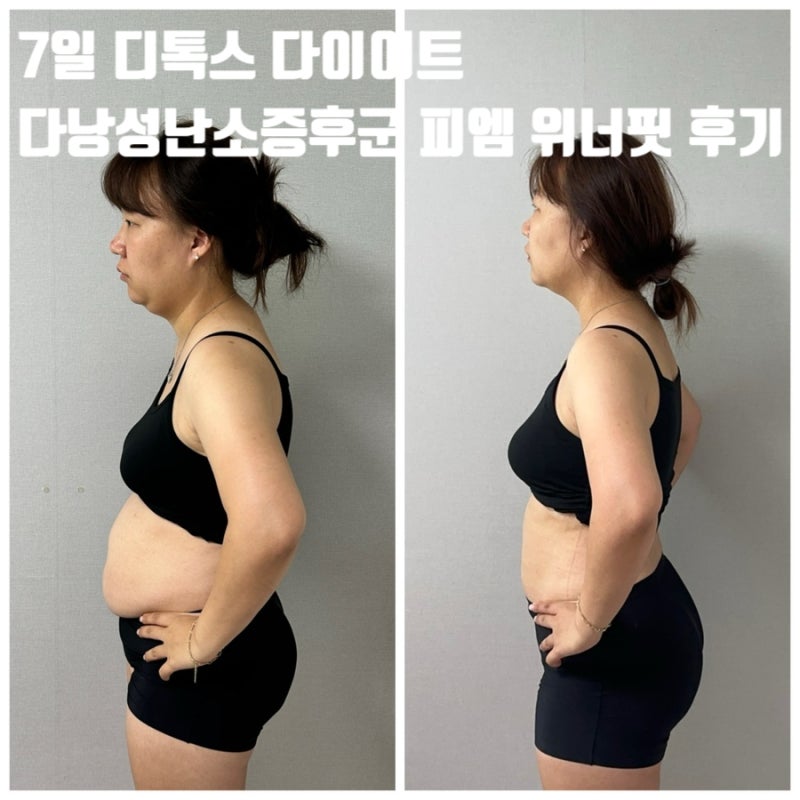 디톡스 7일 다이어트 다낭성난소증후군 피엠 위너핏 후기
