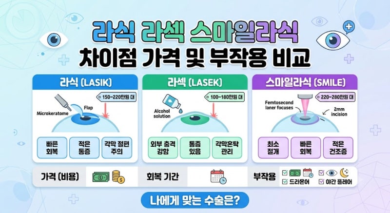 라식 라섹 스마일라식 차이점과 가격 및 부작용 비교 정리