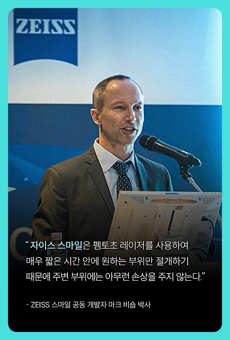 스마일라식비용, 검사 후 추가 금액을 안내받았다면 확인할 내용