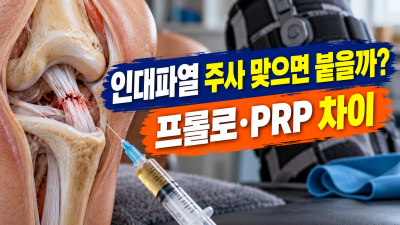 인대파열에 인대주사 맞으면 붙을까? 프롤로·PRP 주사부터 치료 기준까지