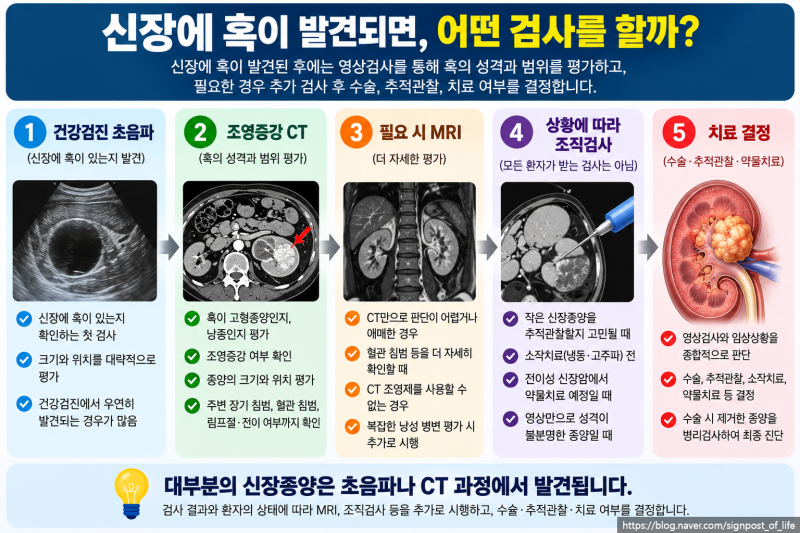 신장암 CT로 알 수 있을까? 조직검사를 안 하는 이유는?