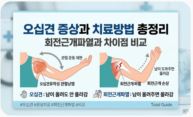 오십견 증상과 치료방법, 회전근개파열과 차이, 도수치료·체외충격파 비수술 치료 및 실비 ....