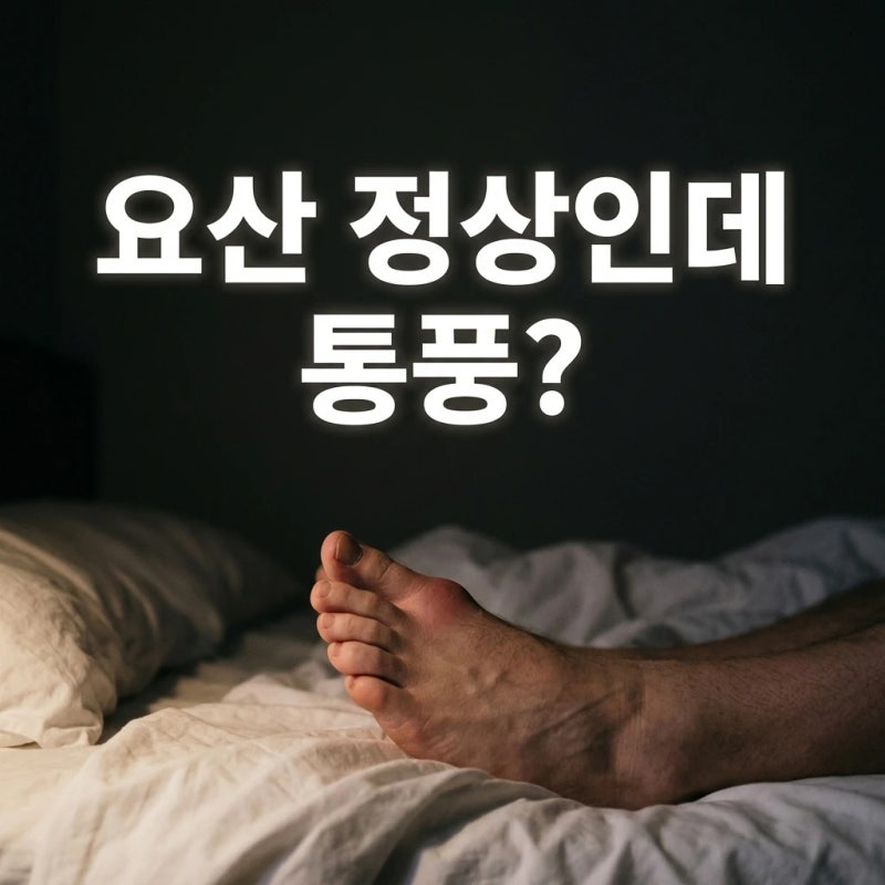 통풍 초기증상, 아플 때 잰 요산이 정상이어도 통풍일 수 있습니다