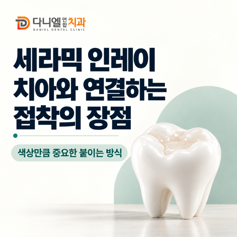 현풍치과 세라믹 인레이의 장점, 치아와 연결하는 접착의 차이
