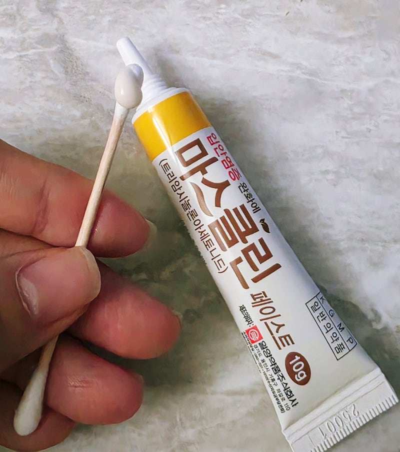 입안 점막 붓고 건조할 때 약국 추천으로 사용해본 일양약품 마스클린 페이스트 구내염 연고....