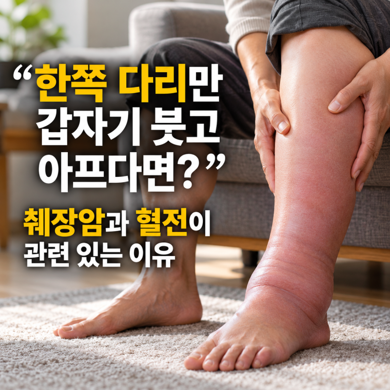 “한쪽 다리만 갑자기 붓고 아프다면?” 췌장암과 혈전이 관련 있는 이유