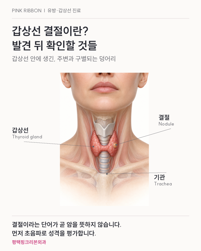 갑상선 결절이 발견됐다면, 크기 외에 무엇을 확인해야 할까요?