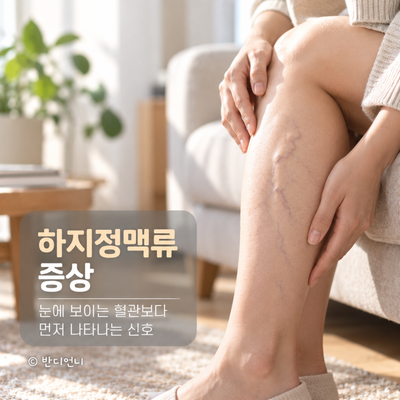 하지정맥류 증상, 눈에 보이는 혈관보다 먼저 나타나는 신호