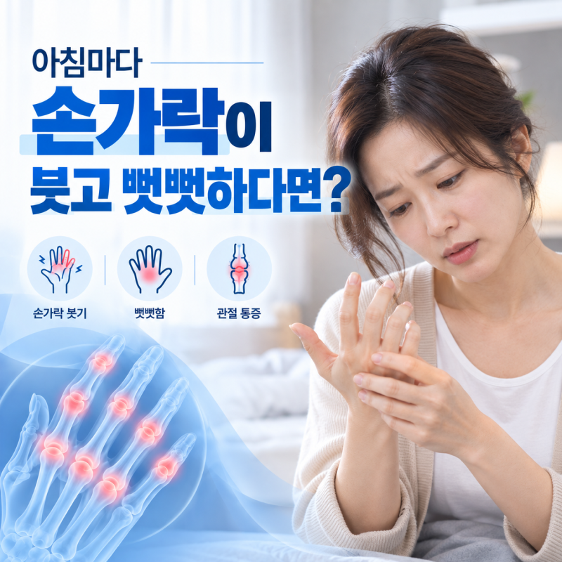 류마티스 관절염 손가락 증상과 퇴행성관절염 구별법 아침마다 손가락이 붓고 뻣뻣하다면