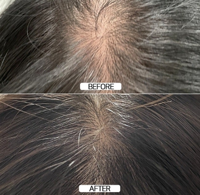 맥주효모샴푸 N통째 비우는 중인 탈모샴푸 추천