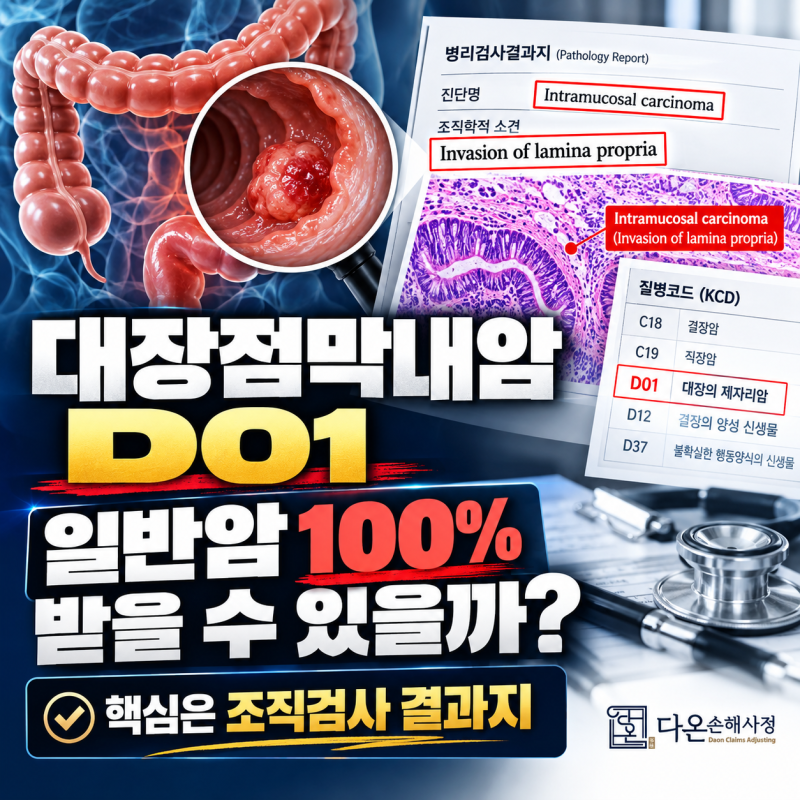 대장점막내암 일반암 지급 기준, D01 코드 제자리암 분쟁 해결법 (조직검사결과지 분석)