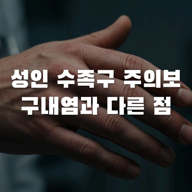 성인 수족구 2026년 대유행? 구내염과 다른 결정적 차이