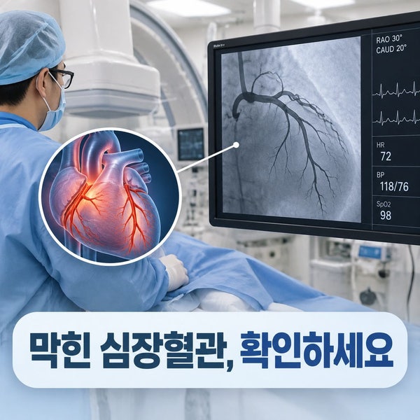 [관상동맥 조영술] 가슴 통증을 느꼈다면 필수! 심근경색 수술 관상동맥조영술 최신 진행 ....