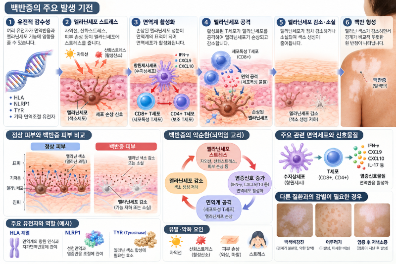 백반증은 왜 생길까?