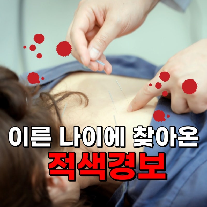 왼쪽 어깨 팔 통증 저림, 목디스크와 관련이 있을까? 6가지 원인 알아보기
