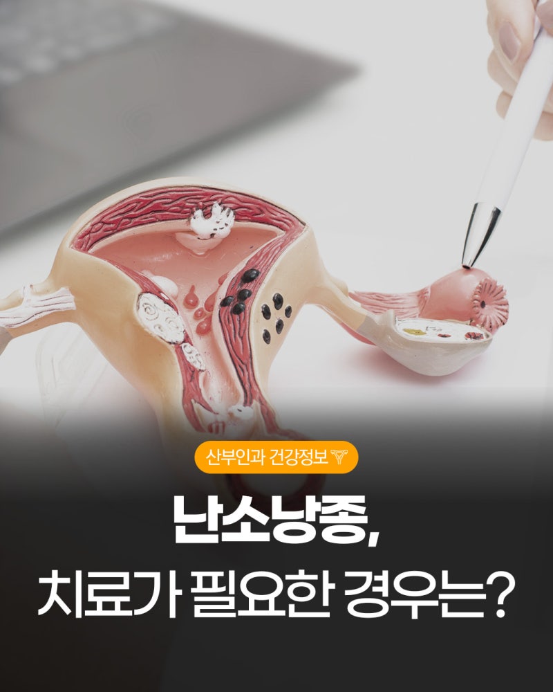 부산난소낭종수술, 난소에 생긴 물혹 치료가 필요한 경우는?