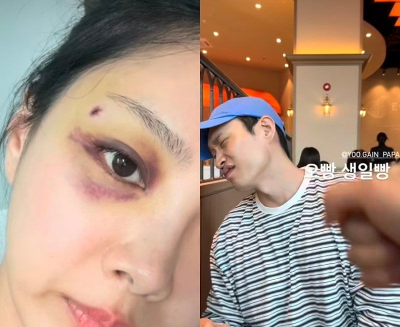 “결혼 앞두고 왜 이래?” 10기 옥순 눈 피멍 이어 예비신랑 유현철과 근황