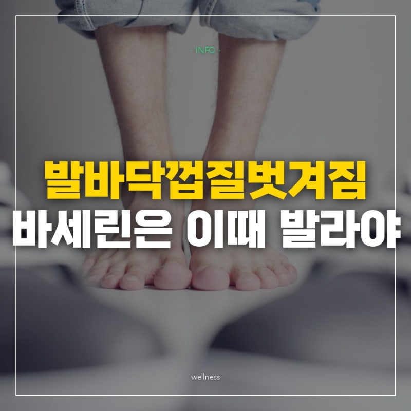 발바닥껍질벗겨짐은 샤워 직후 요소크림을 바르고 자기 전에야 바세린을 덮는 이유