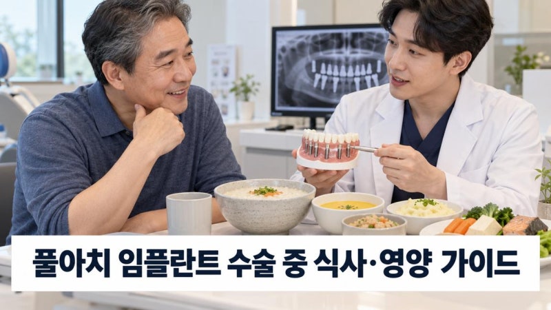 전체 임플란트(풀아치) 수술 기간 중 식사 방법과 유동식 영양 섭취 가이드