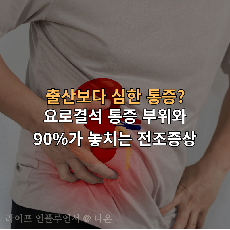"출산보다 심한 통증?" 요로결석 통증 부위와 90%가 놓치는 전조증상