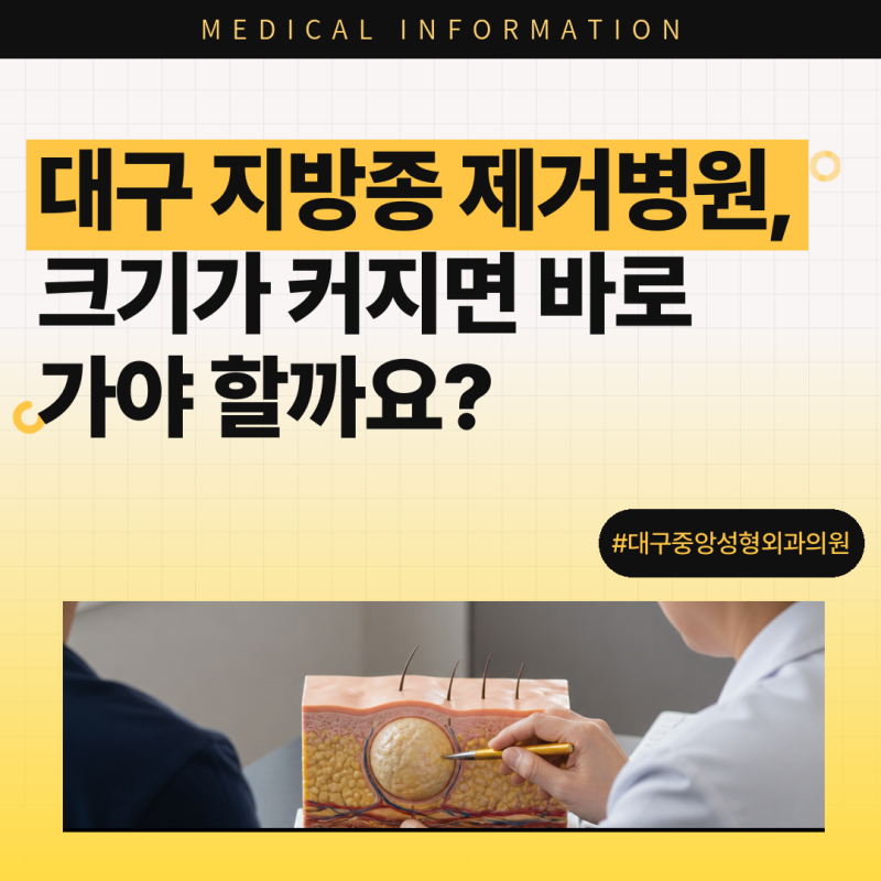 대구 지방종 제거병원, 크기가 커지면 바로 가야 할까요?