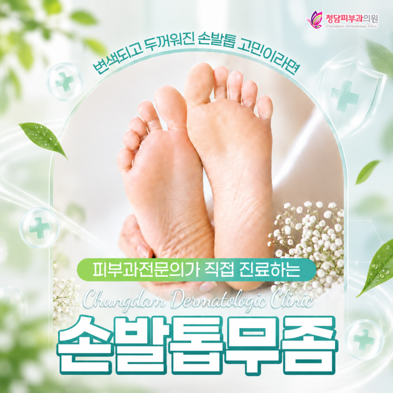 대전 피부과 전문의 손발톱 무좀 3단계 관리로 뽀송해질까?