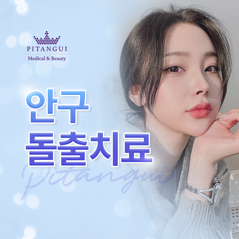 안구 돌출 치료, 꼭 수술해야 할까요? 원인에 따라 달라집니다｜신논현역성형외과
