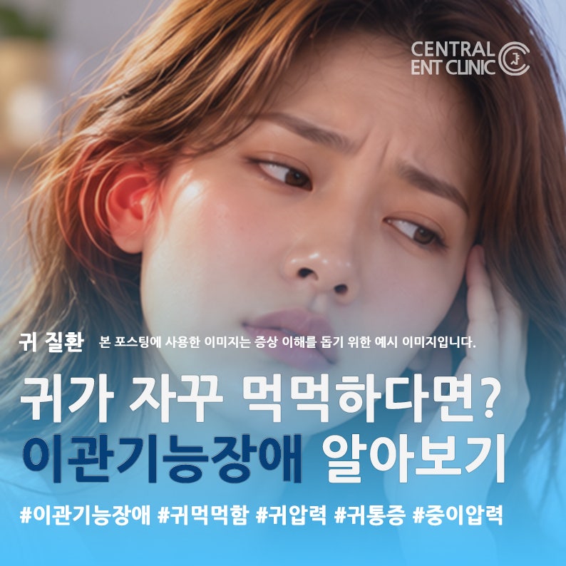 귀가 자꾸 먹먹하고 압력이 차는 느낌이 든다면? 이관기능장애 알아보기