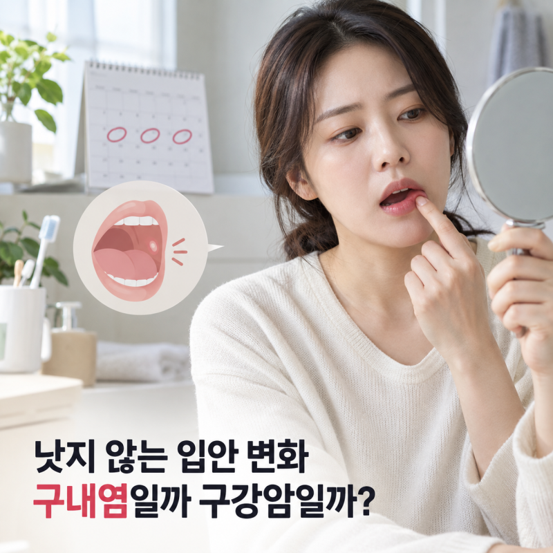 구내염과 헷갈리는 구강암 초기증상, 3주 넘는 입안 변화 확인하기