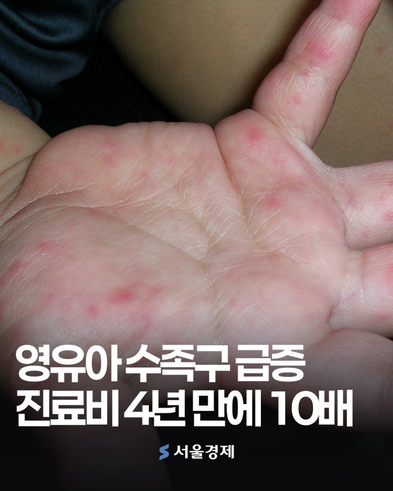 올여름 수족구병 영유아 급증, 부모님이 꼭 알아야 할 것들 [헬시타임]