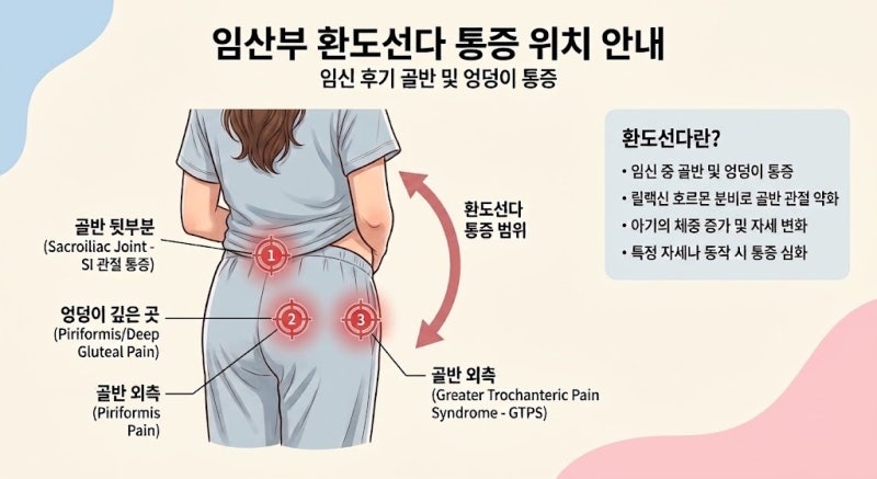 임산부 환도선다 통증, 이렇게 심해질 줄이야 | 임신 20~29주 경험 + 산전 복대, 온열팩 후기