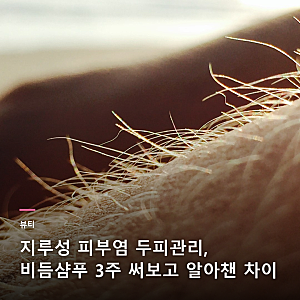 지루성 피부염 두피관리, 비듬샴푸 3주 써보고 알아챈 차이