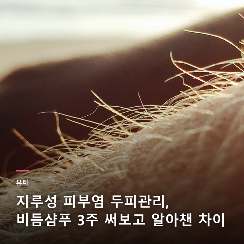 지루성 피부염 두피관리, 비듬샴푸 3주 써보고 알아챈 차이
