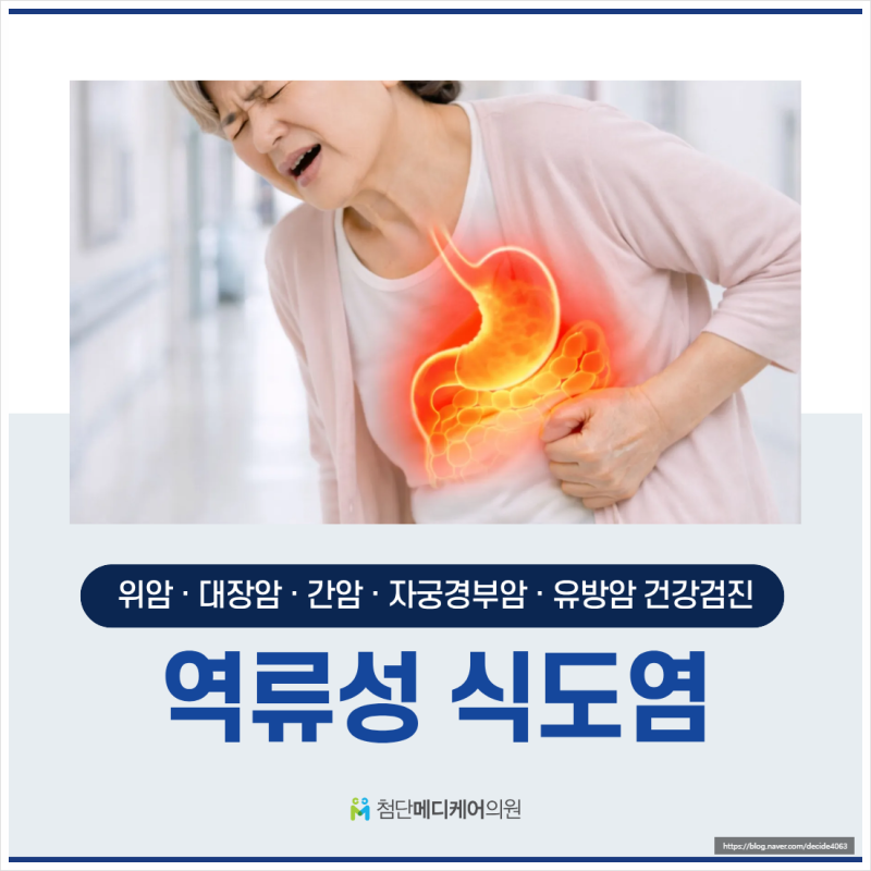 광주 내시경 병원에서 역류성식도염을 어떻게 진단하나요?