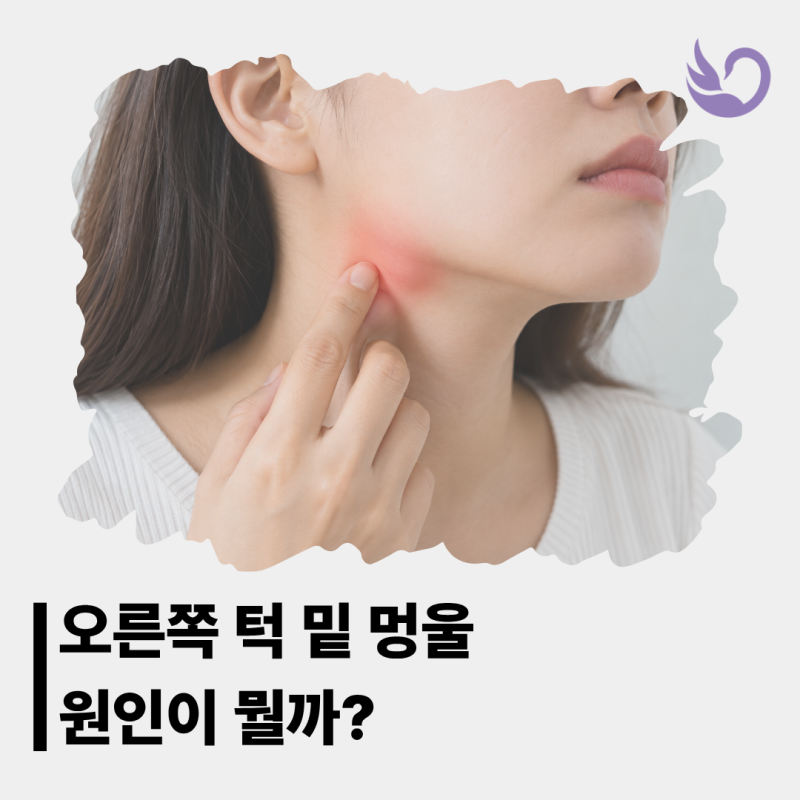 오른쪽 턱 밑 멍울 찌릿 통증 부음 원인이 뭘까?