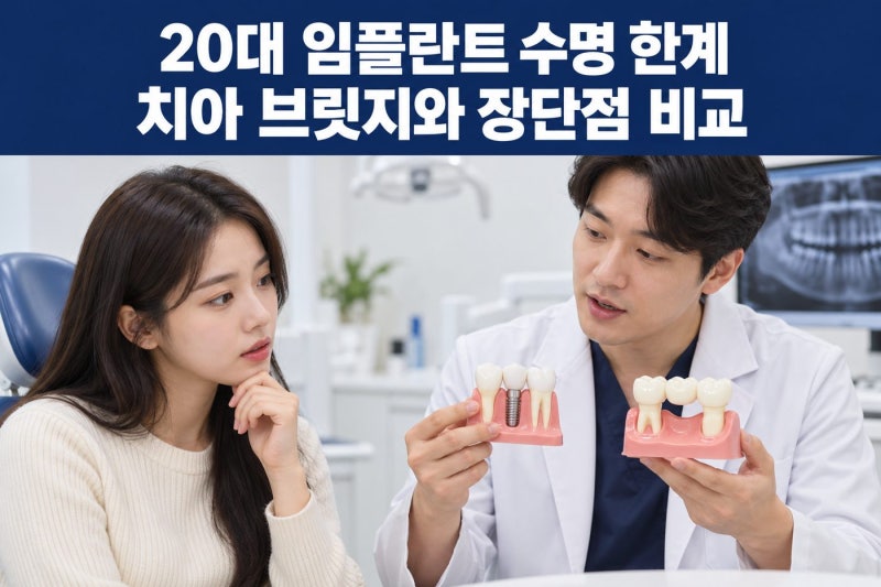 20대 젊은 나이 임플란트 수명 한계와 치아 브릿지 치료와의 장단점 비교