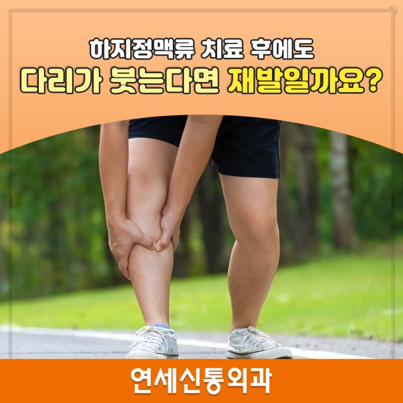 [과천 하지정맥류 병원] 하지정맥류 치료 후에도 다리가 붓는다면 재발일까요?