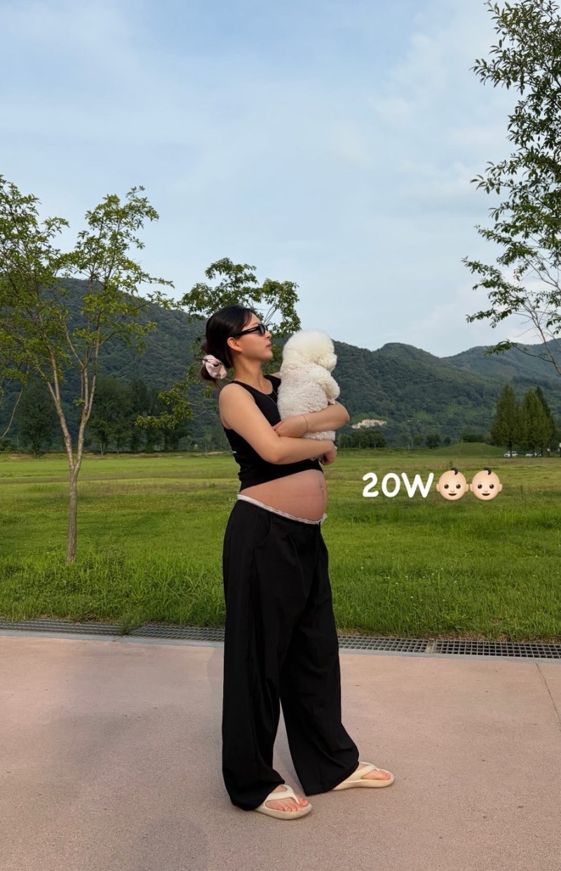 [쌍둥이 임신 17주~20주]쌍둥이 배크기, 임산부 하지정맥, 이대서울 중기 정밀초음파