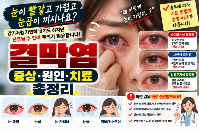 눈이 빨갛고 눈곱이 끼며 가렵다면? 결막염 증상·원인·치료 총정리