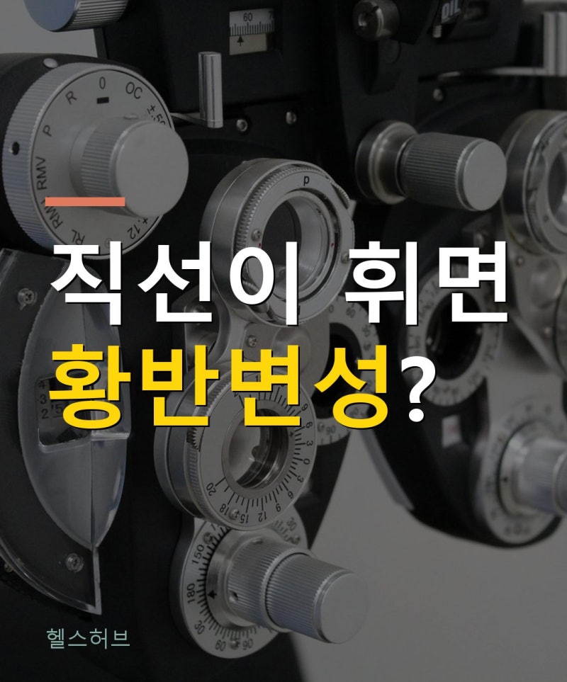 황반변성 증상·루테인 많은 음식, 직선이 휘어 보이면 실명 신호일까?