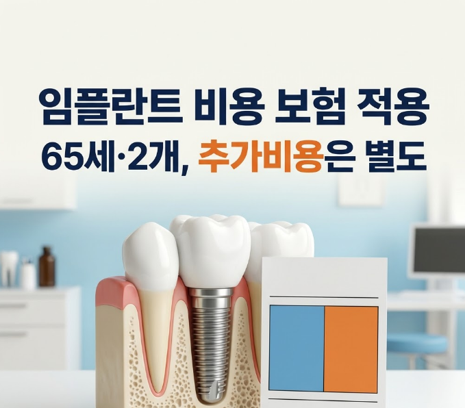 임플란트 비용 보험 적용 "최종 견적" 보는 법, 어금니 가격·치료기간까지