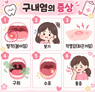 구내염 약 오라메디 알보칠 둘 다 써보고 알게 된 차이