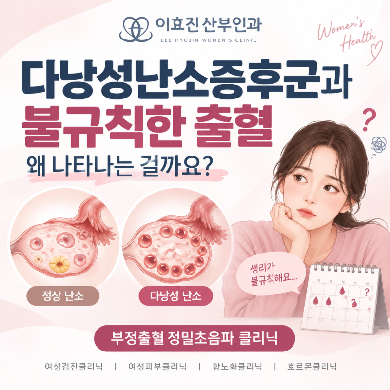반포역 산부인과 다낭성난소증후군과 불규칙한 출혈, 왜 함께 나타날까요?