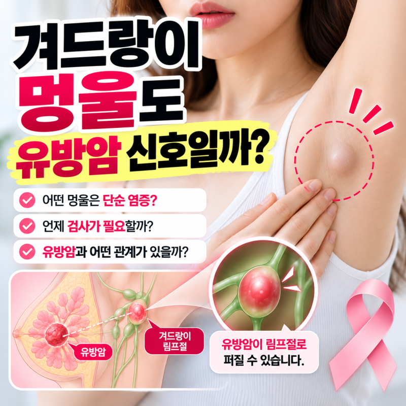 겨드랑이 멍울도 유방암 신호일까? 림프절과 유방암의 관계